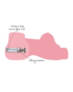 Masturbator Horny Milking Bitch 10kg